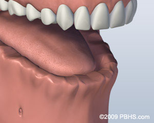 Missingallow treatment